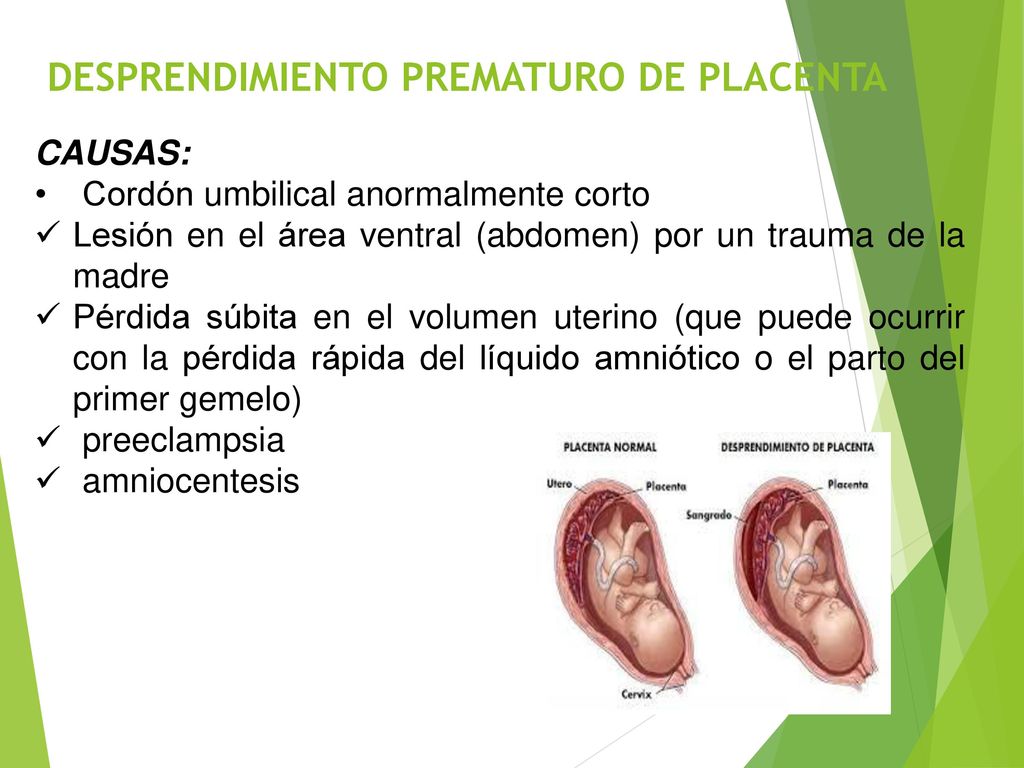 desprendimiento de placenta sintomas de diabetes desprendimiento de placenta sintomas de diabetes